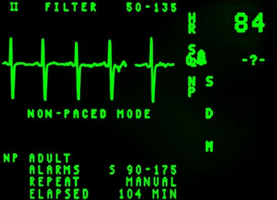 electrocardiogram-16948_640