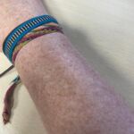 LA PELIGROSA MODA DEL BRONCEADO QUE AMENAZA LA SALUD DE LA POBLACIÓN