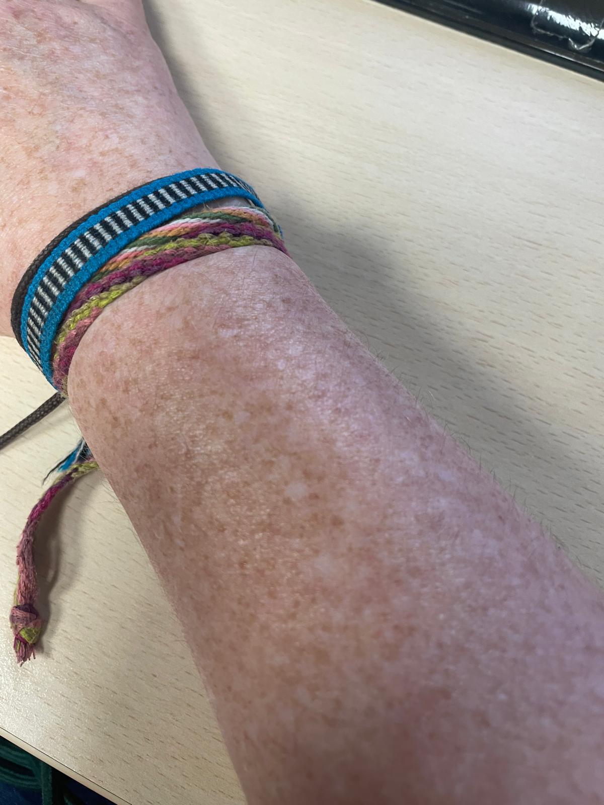 LA PELIGROSA MODA DEL BRONCEADO QUE AMENAZA LA SALUD DE LA POBLACIN -  Colegio Oficial de Mdicos de Santa Cruz de Tenerife